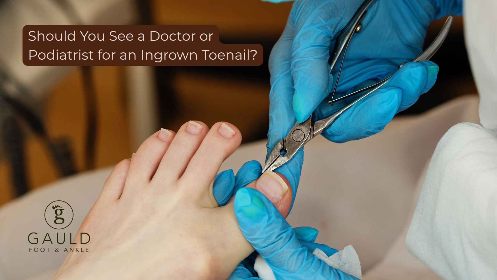ingrown toenail