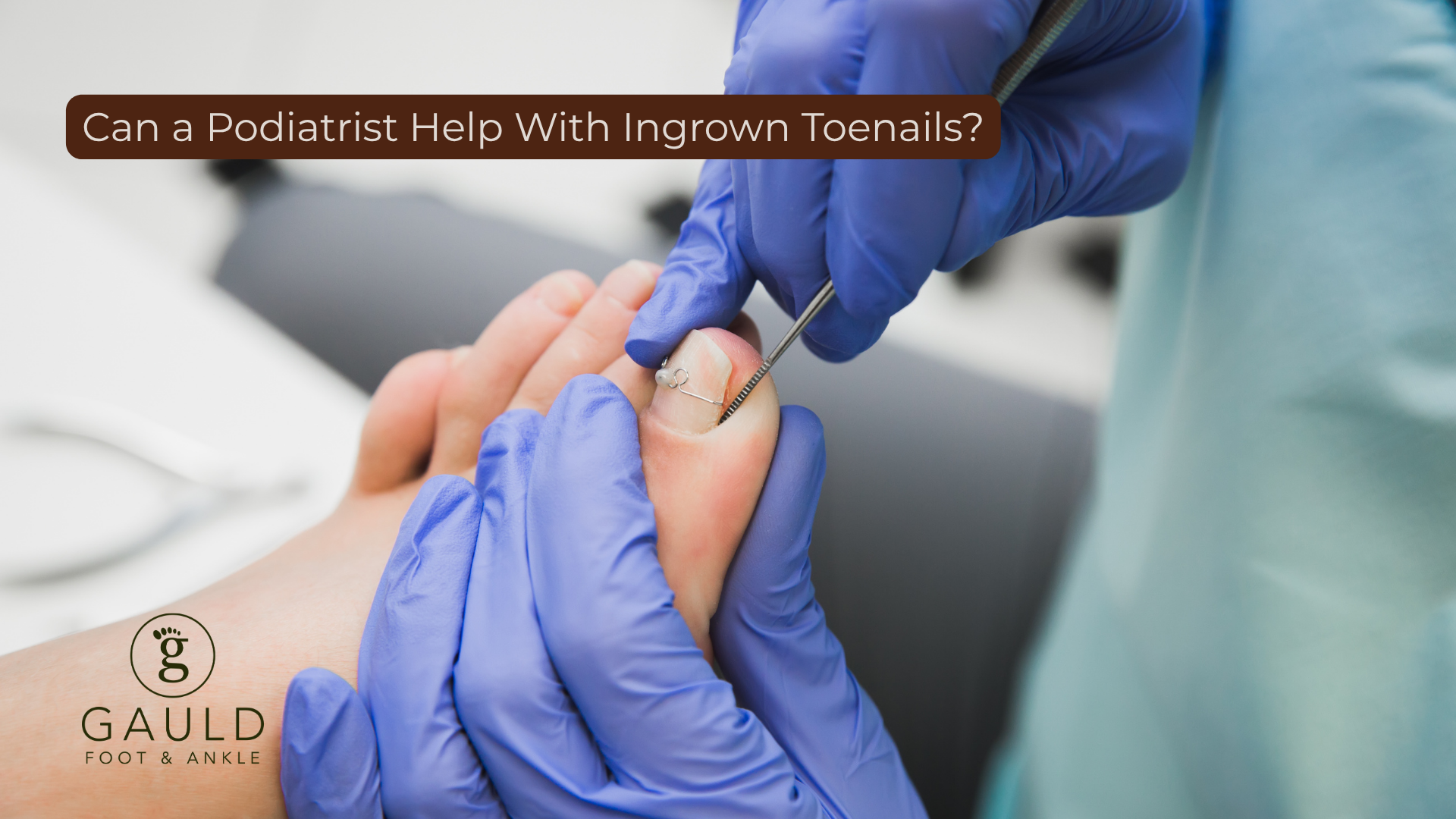 ingrown toenail